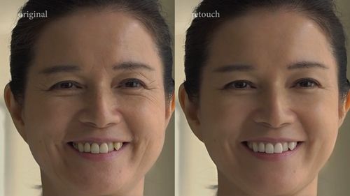 Age_Reduction_FX.jpg